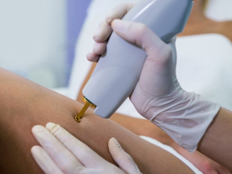 tsiogkaderma dermatologiko