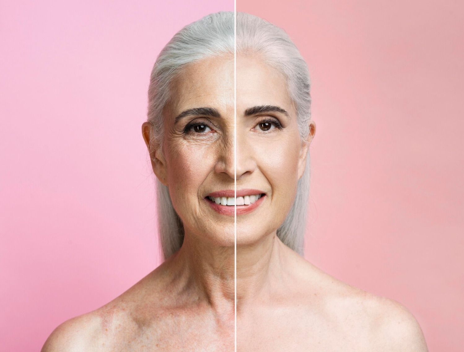 tsiogkaderma dermatologiko